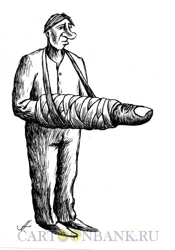 Карикатура: палец в гипсе, Гурский Аркадий