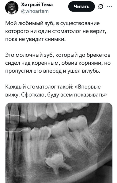 Мем: Какой воспитанный зуб., henh