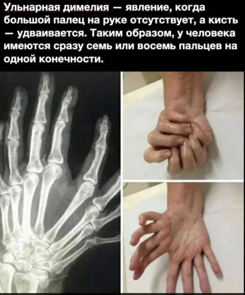 Мем, михельсон