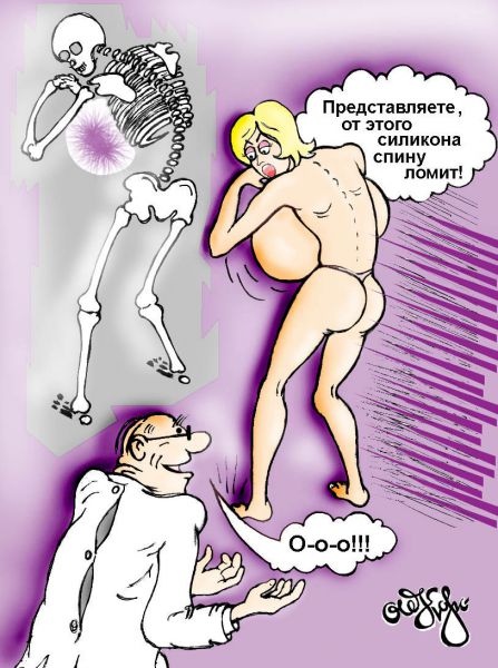 Карикатура: силикон, Корсунов Олег